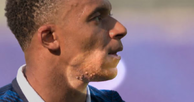 Kylian Mbappé skin rash